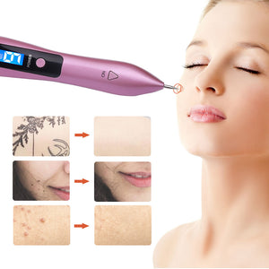 Laser Dark Spot Remover Pen Kit | Remove Dark Spots Moles Warts Tattoos Machine